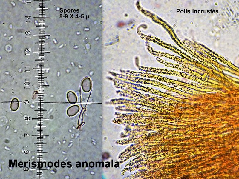 Merismodes anomala-amf2087-micro.jpg - Merismodes anomala ; Syn1: Peziza anomala ; Syn2: Cyphella anomala